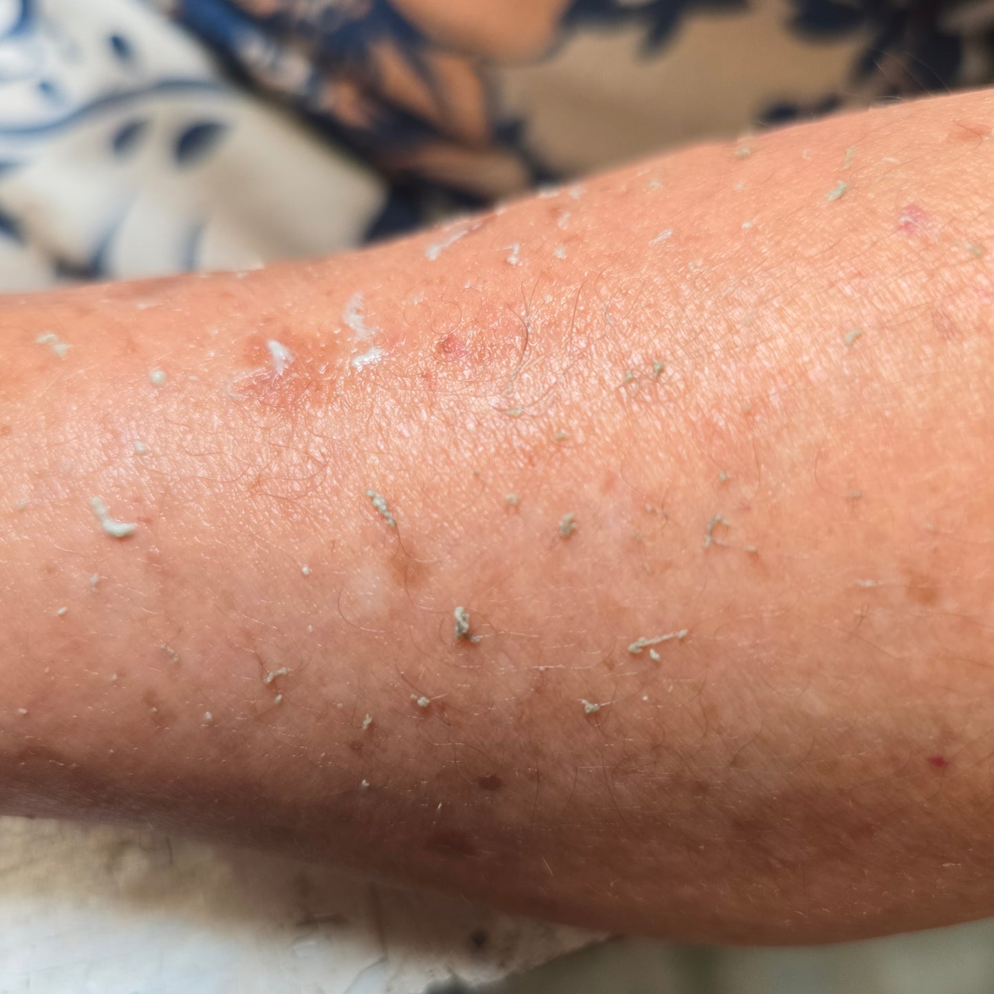 Gel Exfoliante de Áloe Vera Efecto Inmediato